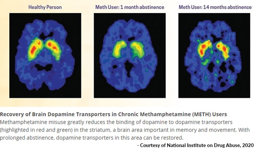 PPR Meth Brain Scans