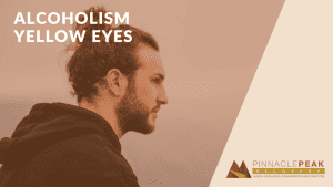 alcoholism and yellow eyes